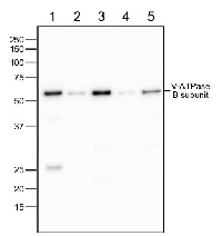 V-ATPase, B | vacuolar H+-ATPase subunit B in the group Antibodies Plant/Algal / Membrane Transport System / Vacuolar membrane at Agrisera AB (Antibodies for research) (AS14 2775)